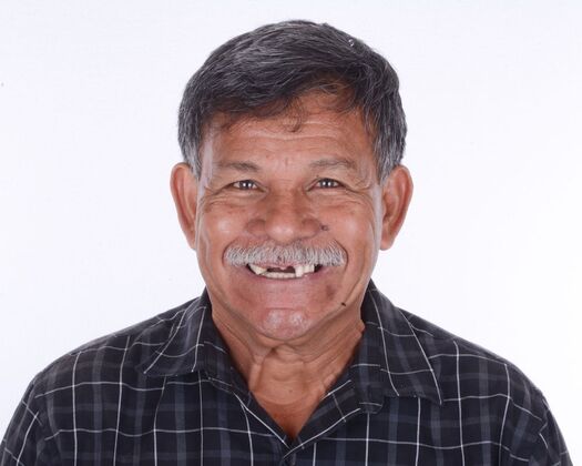 Before dental implant treatment